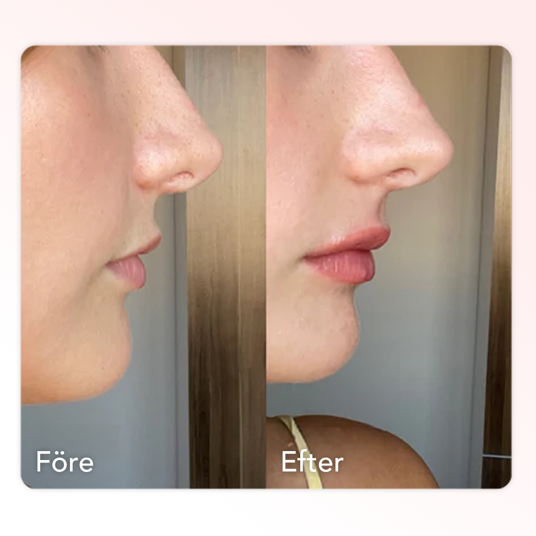 Collagen Lip Plumper