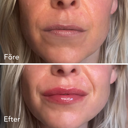 Silky Extreme Lip Plumper