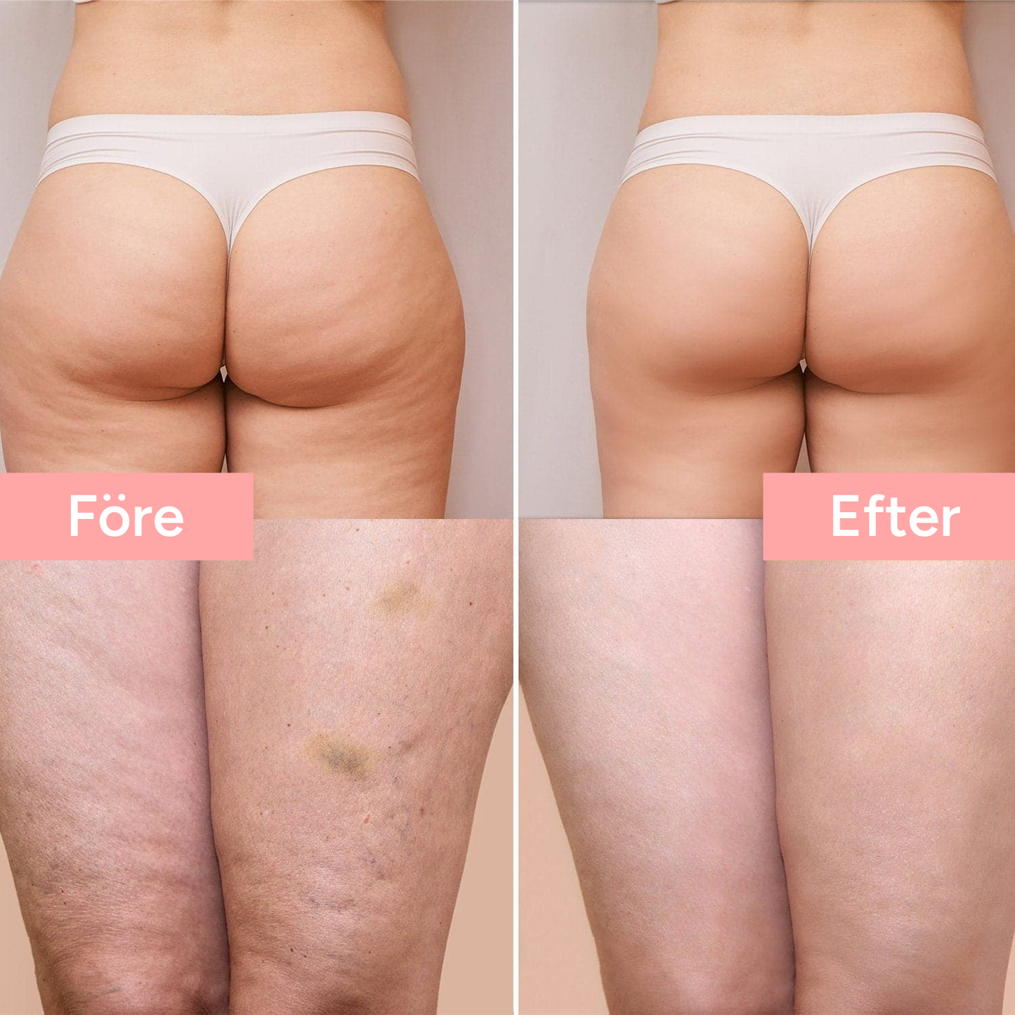 Anti-Cellulite Collagen Oil