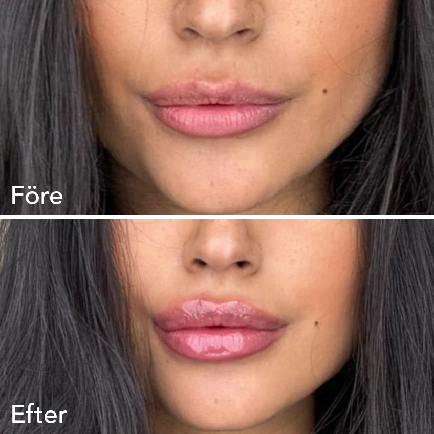 Collagen Lip Plumper